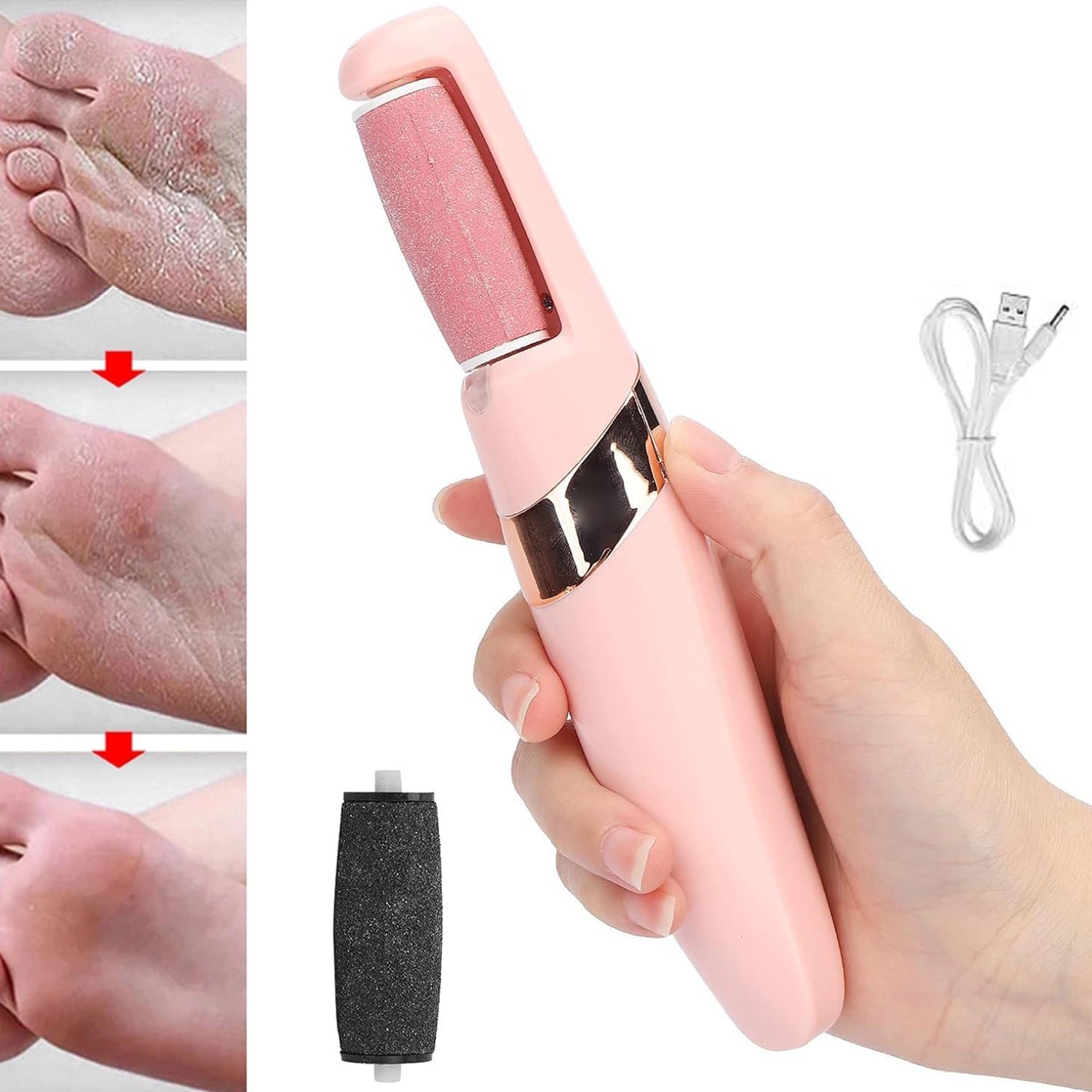 01_dd110c15-b097-40a2-af3d-47f85a6f01b3.jpg Flewless Pedi Electronic Pedicure Tool (1 Set) - Image 1